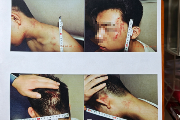 缩略图 | 17岁男生遭假警察上门殴打，被强迫跪下磕头叫爹！