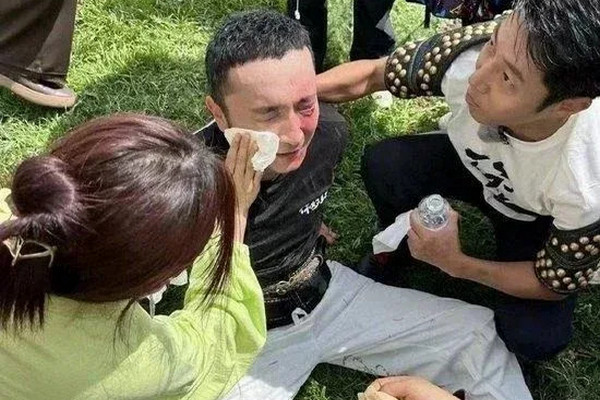 缩略图 | 看着都疼！央视知名主持人录节目时发生意外！