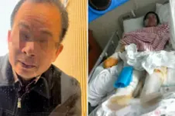 缩略图 | 男子求爱遭拒，等民警离开后泼硫酸捅刺女子数十刀，终审判死刑！