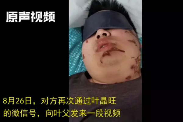 缩略图 | 中国留学生被华裔绑架，花570万重金赎回！电击铁链，血迹斑斑，惨不忍睹！