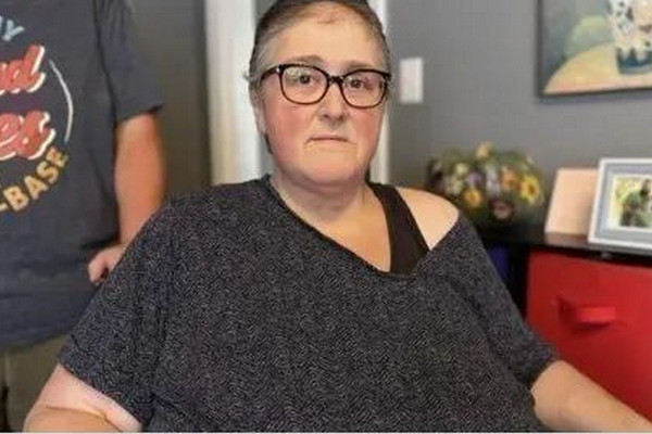 缩略图 | 被误诊一年多，加拿大女子圣诞节离世！