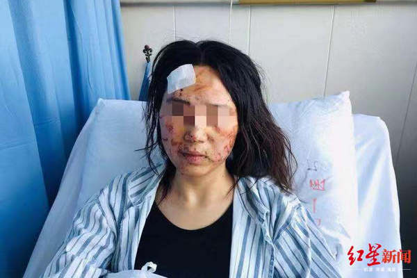 缩略图 | 温州女子被公公丈夫暴打毁容涂大便，简直丧心病狂！