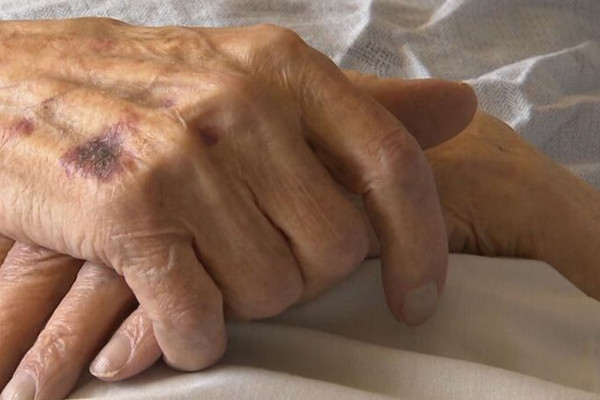 缩略图 | 妻子患上老年痴呆，加拿大男子多次计划杀妻再自杀！